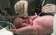 Problémom, nielen v pôrodníctve, je nezvládnutie komunikácie zdravotníkov s pacientmi